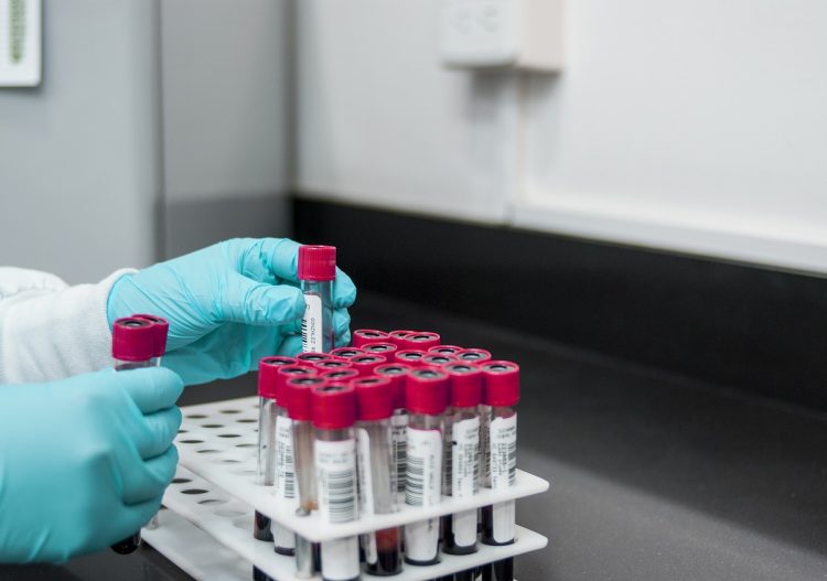 Un laboratin manipulant des pipettes.
